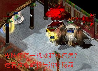 Ƥ������һ�Ӿ���С�����ٿ����Խ����������ؼ�